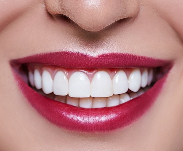 Woman with gorgeous smile after aesthetic crown lengthening and gum recontouring