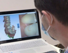 Periodontist looking at digital smile design on computer