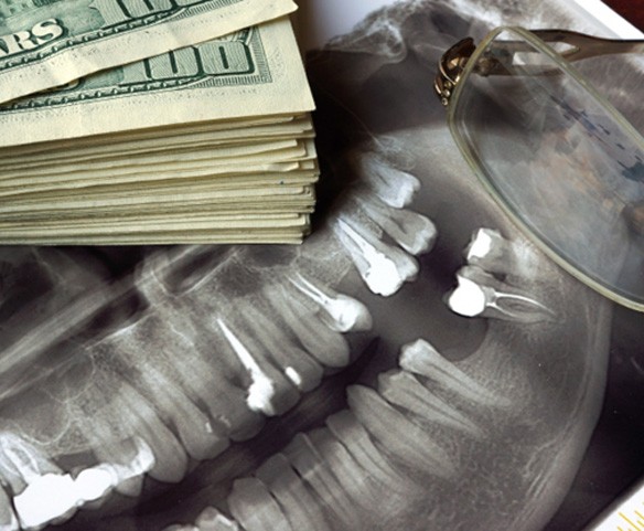 Dental x-ray with money next to it