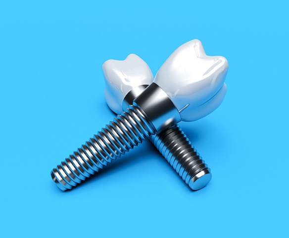 Closeup of dental implants in Lincoln on blue background