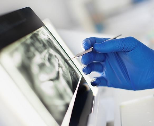 Periodontist reviewing smile x-rays