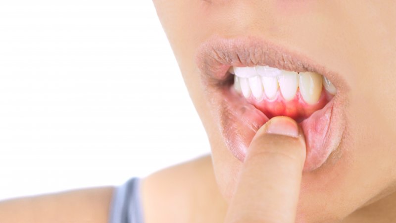 Woman in need of gum disease treatment in Lincoln