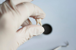 Gloved hand holding an extracted tooth